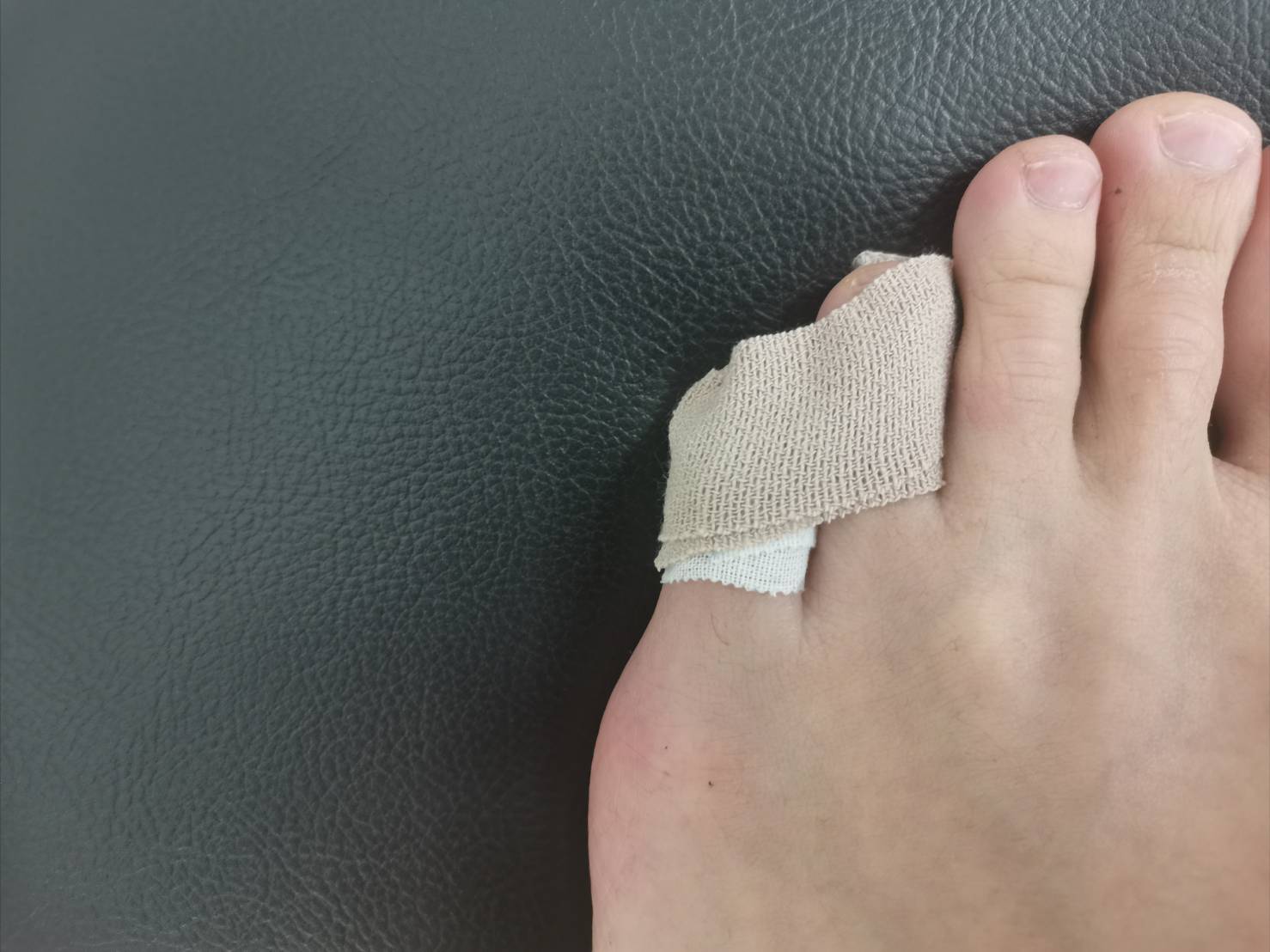 足 の 小指 ぶつけ た 歩く と 痛い