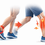 【所沢】シンスプリントは足首の硬さが原因？接骨院が解説